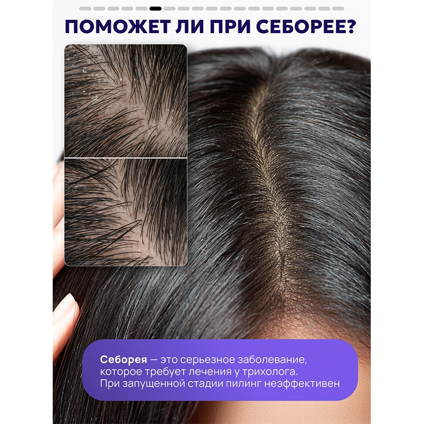 Пилинг для кожи головы `SEMILY` с комплексом кислот 150 мл