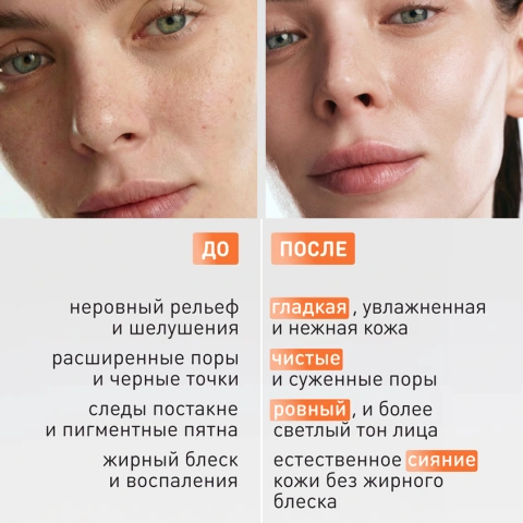 ProductImage